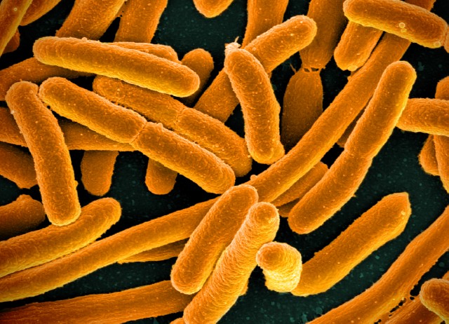 E._coli_Bacteria_(16598492368).jpg