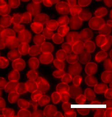 Sedimented_red_blood_cells.jpg