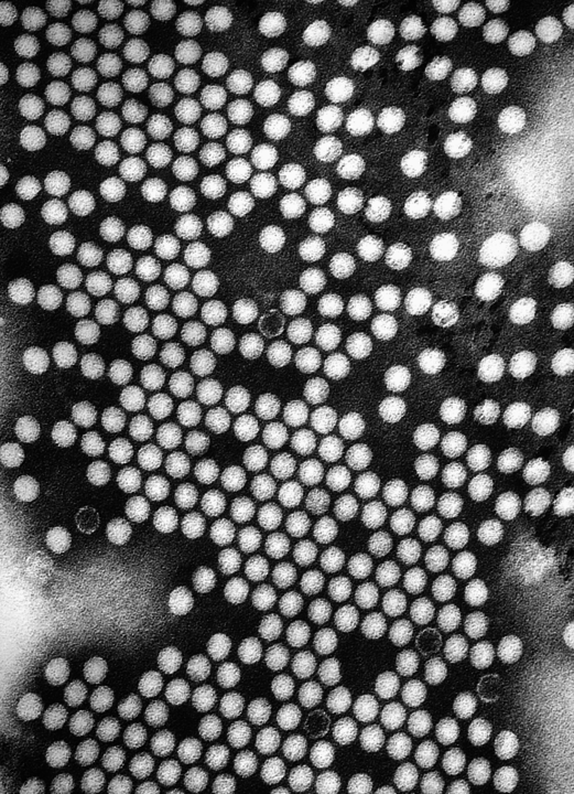 521px-Polio_EM_PHIL_1875_lores.png