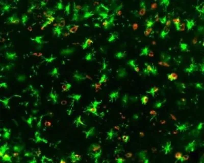 COVID-19-Infected-Mouse-Brain-Angry-Microglia-400x321.webp