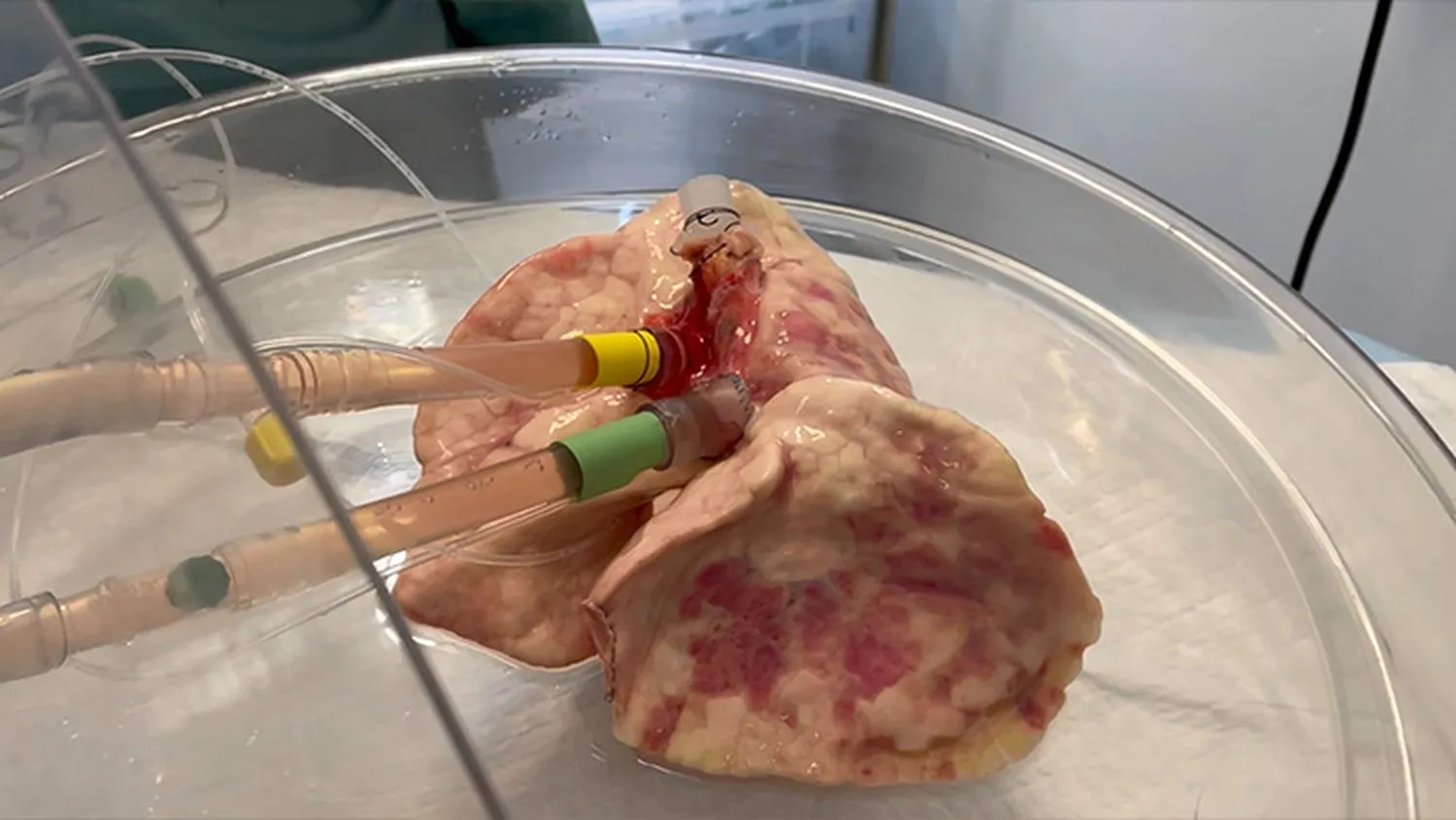 Perfused-Lung.webp