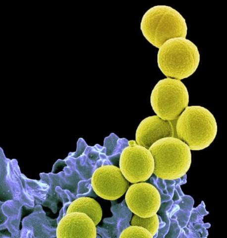 2023 Otto Lancet Microbe phase 2 image.jpg