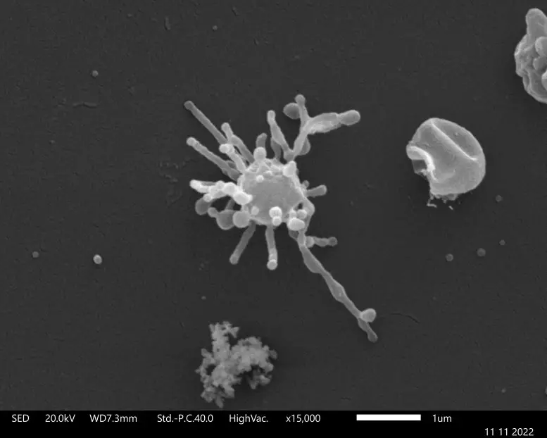 Scanning-Electron-Micrograph-of-a-Lokiarchaeum-ossiferum-777x622.webp