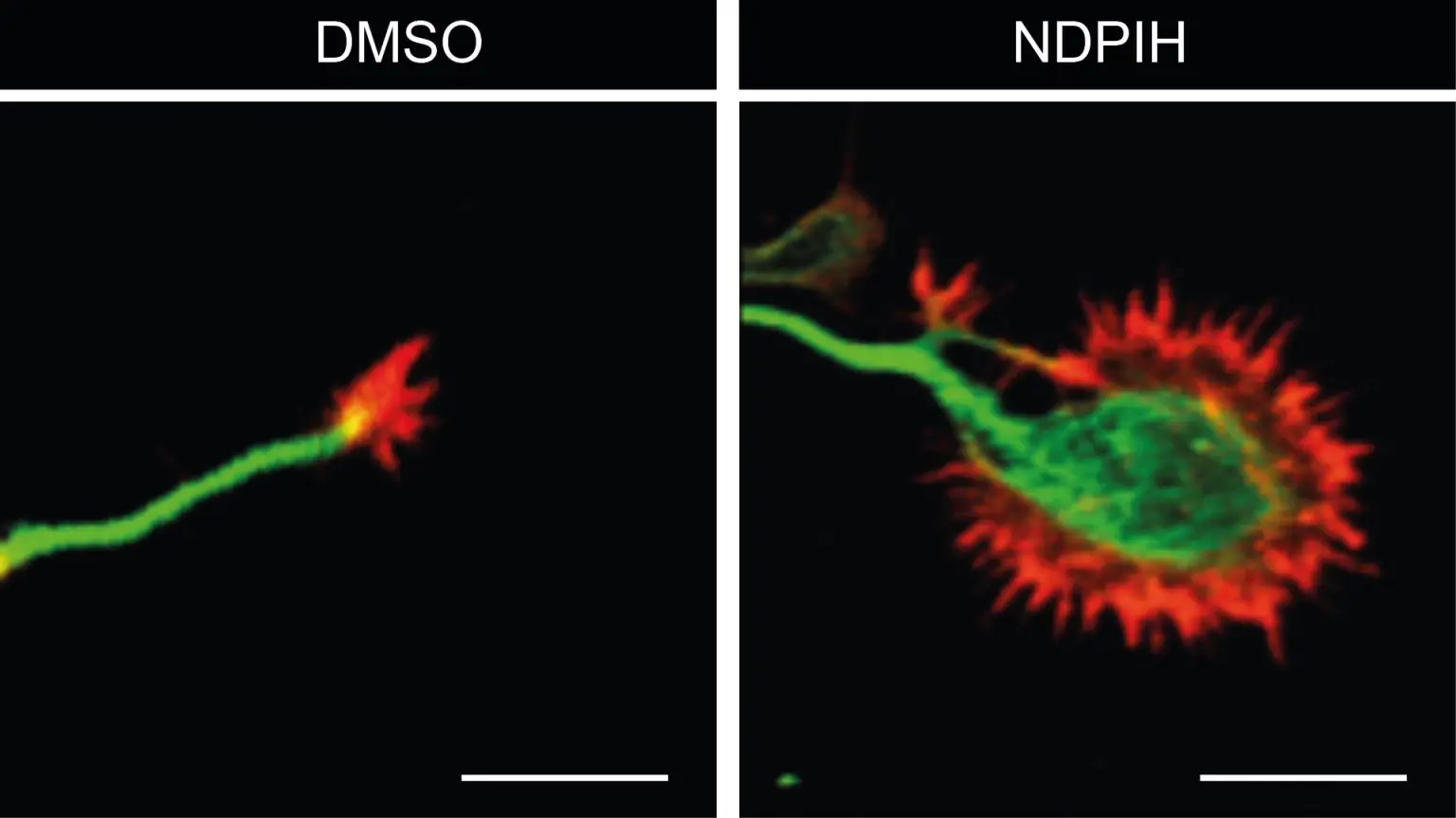 Control-and-Treated-Neuron-Growth-Cones-Comparison-1536x863.webp