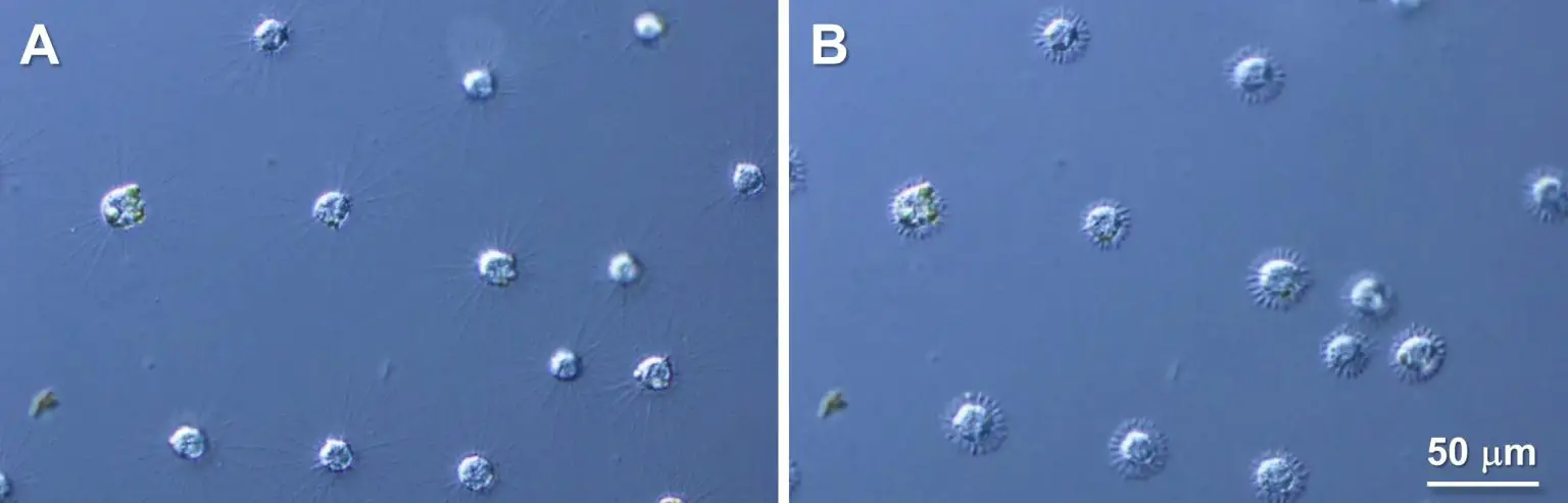 Rapid-Axopodial-Shortening-Seen-in-Raphidocystis-contractilis-1536x493.webp
