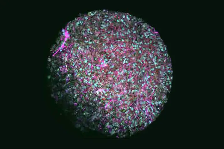 AI-Brain-Organoid-777x518.webp
