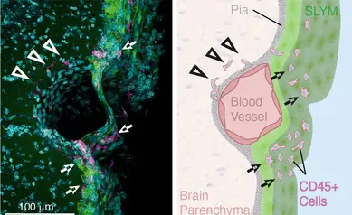 Central-Nervous-System-Immune-Cells-SLYM.webp