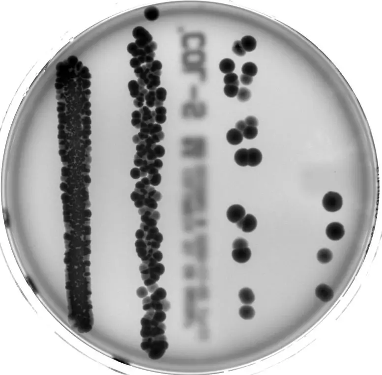 Gut-Bacteria-in-a-Petri-Dish-777x763.webp