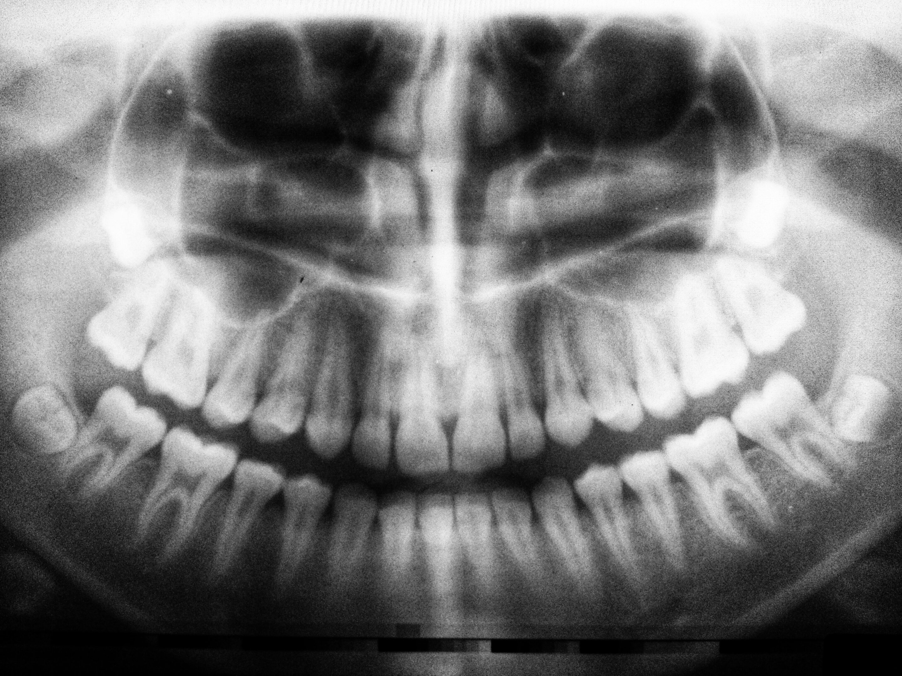dental-xray.jpg