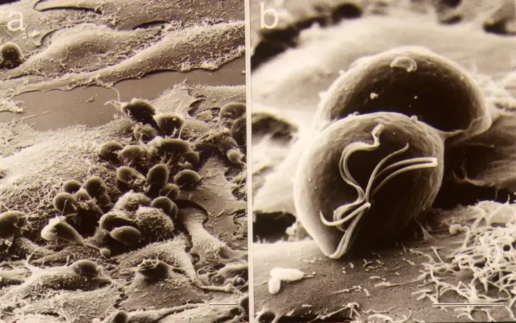 Ellipsoid-Tvag-on-HeLa-Cells.webp