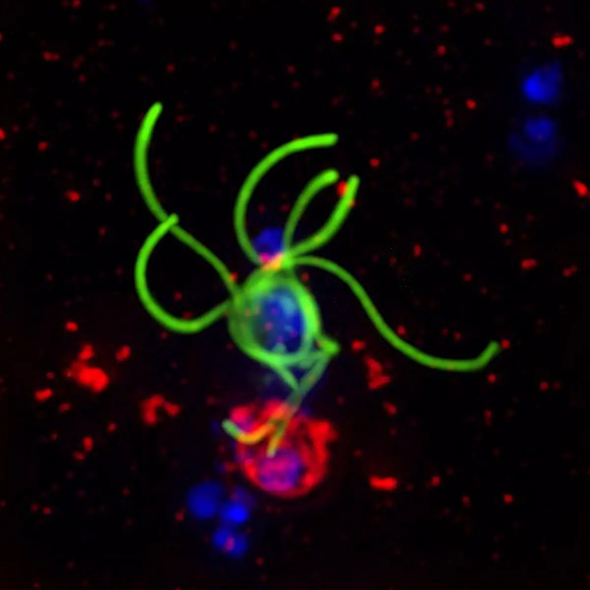 Human-Red-Blood-Cells-Infected-With-Malaria-Parasite.webp
