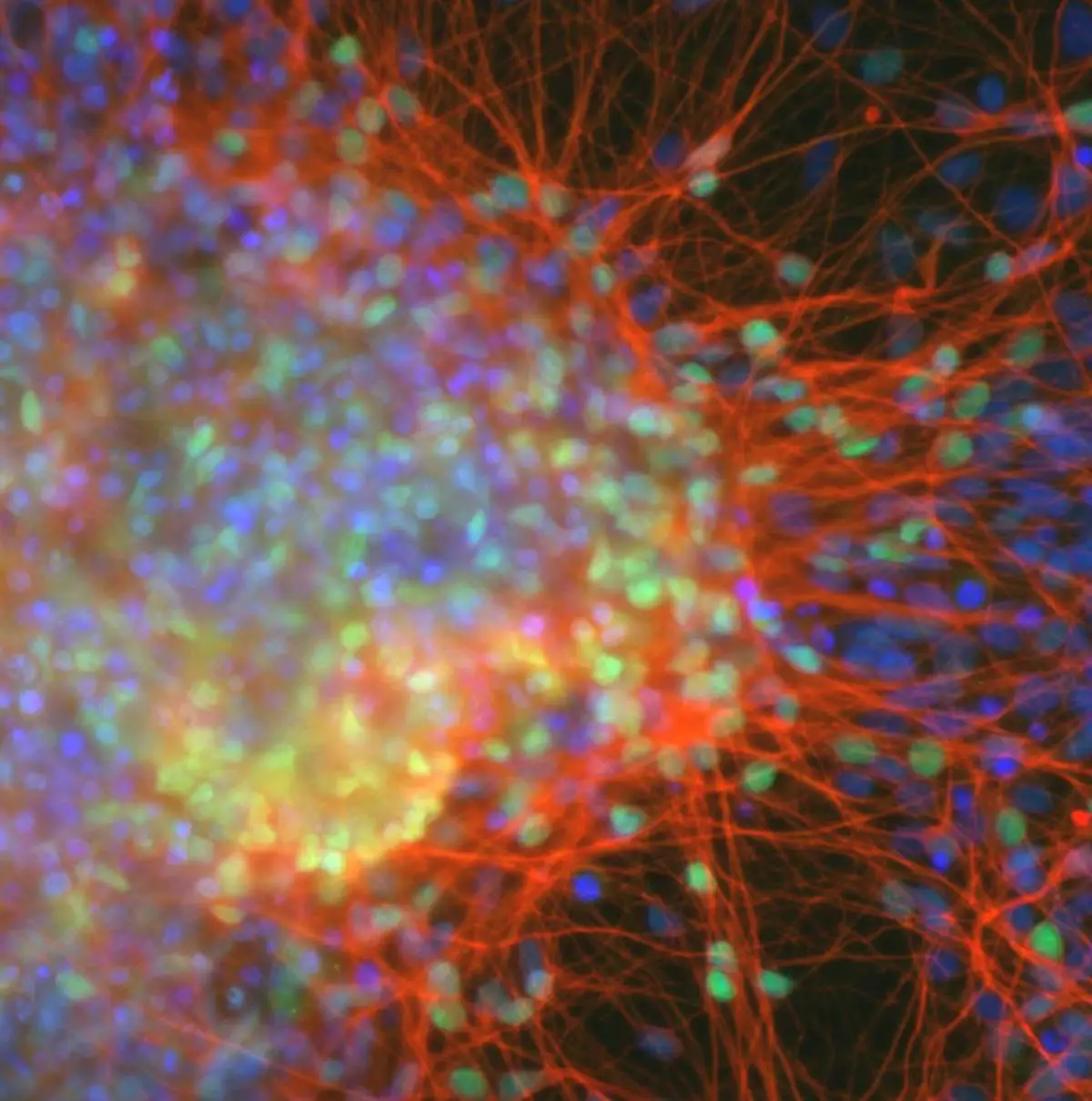 Cortical-Neurons.webp