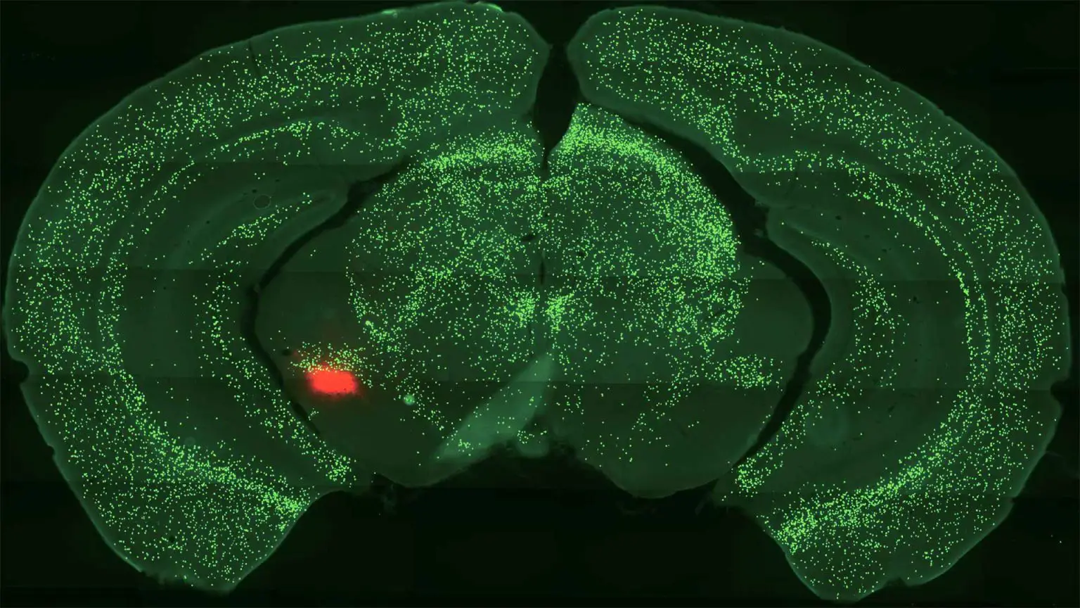 Mouse-Central-Amygdala-1536x864.webp