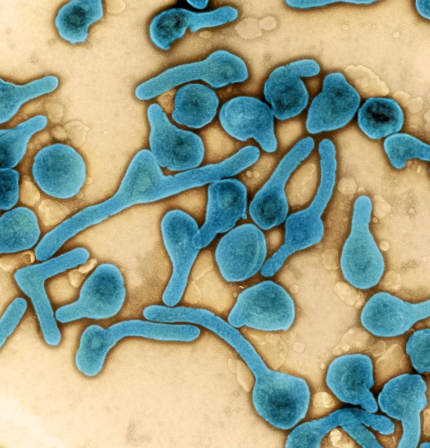 Marburg-Virus-Particles-Harvested-From-Infected-Cell-1473x1536.webp