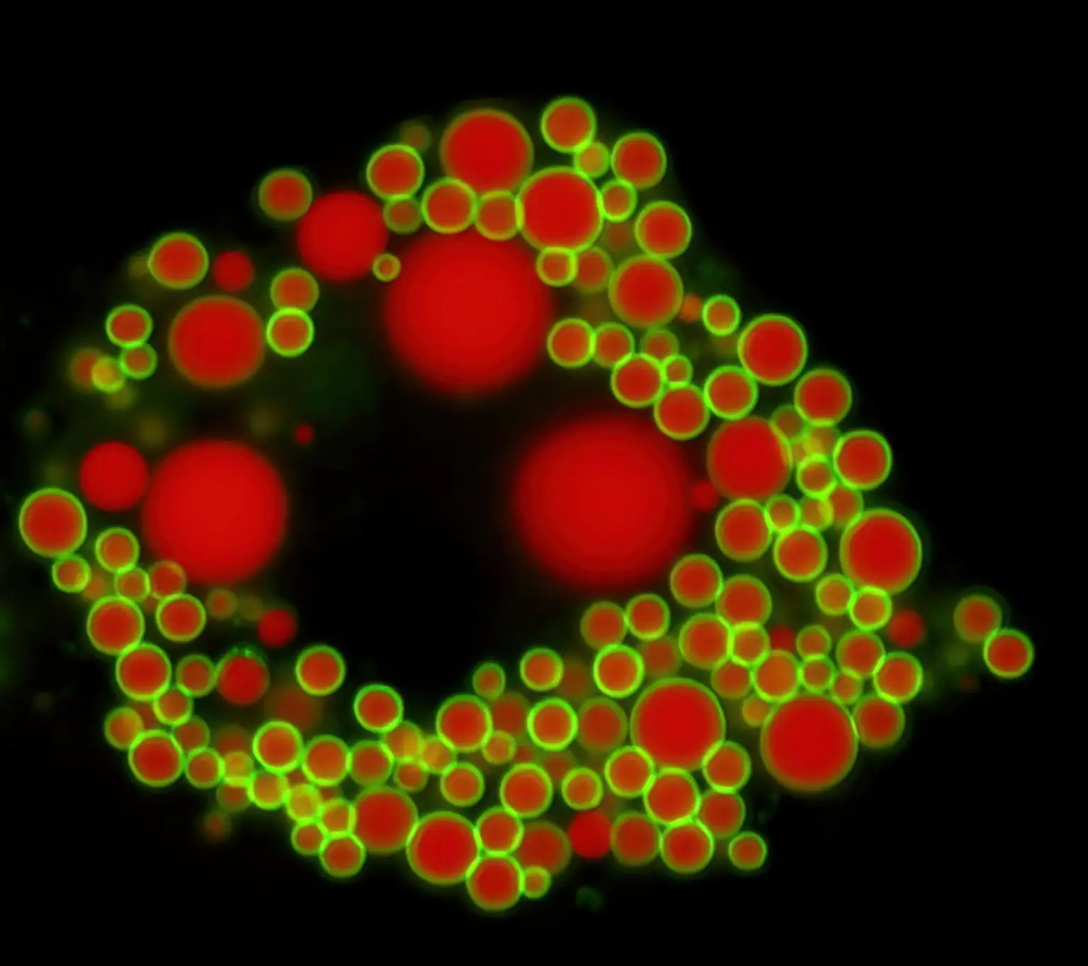 Fat-Droplets-in-the-Fat-Cell-of-a-Mouse-1536x1364.webp