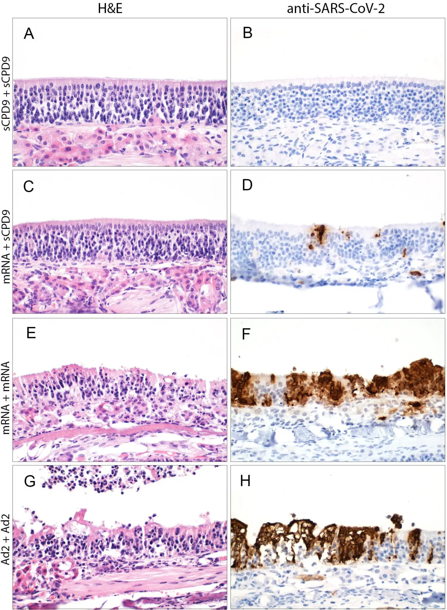 Nasal-Vaccine-Comparison-1502x2048.webp