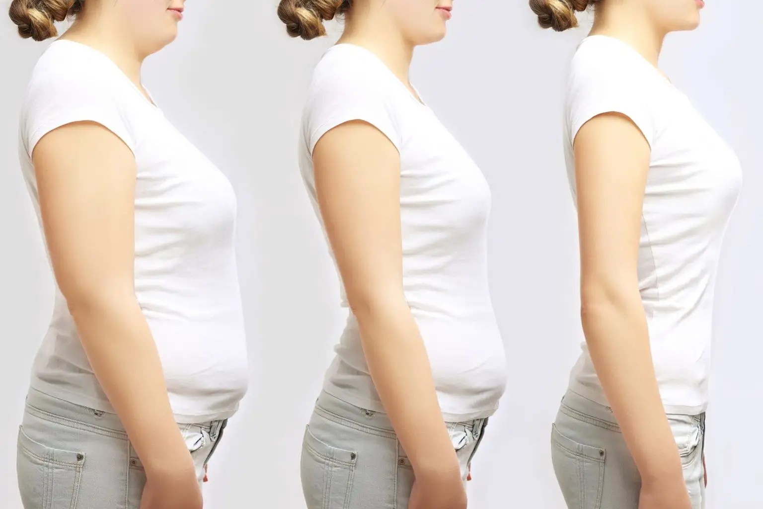 Obesity-Weight-Loss-Concept-1-1536x1024.webp