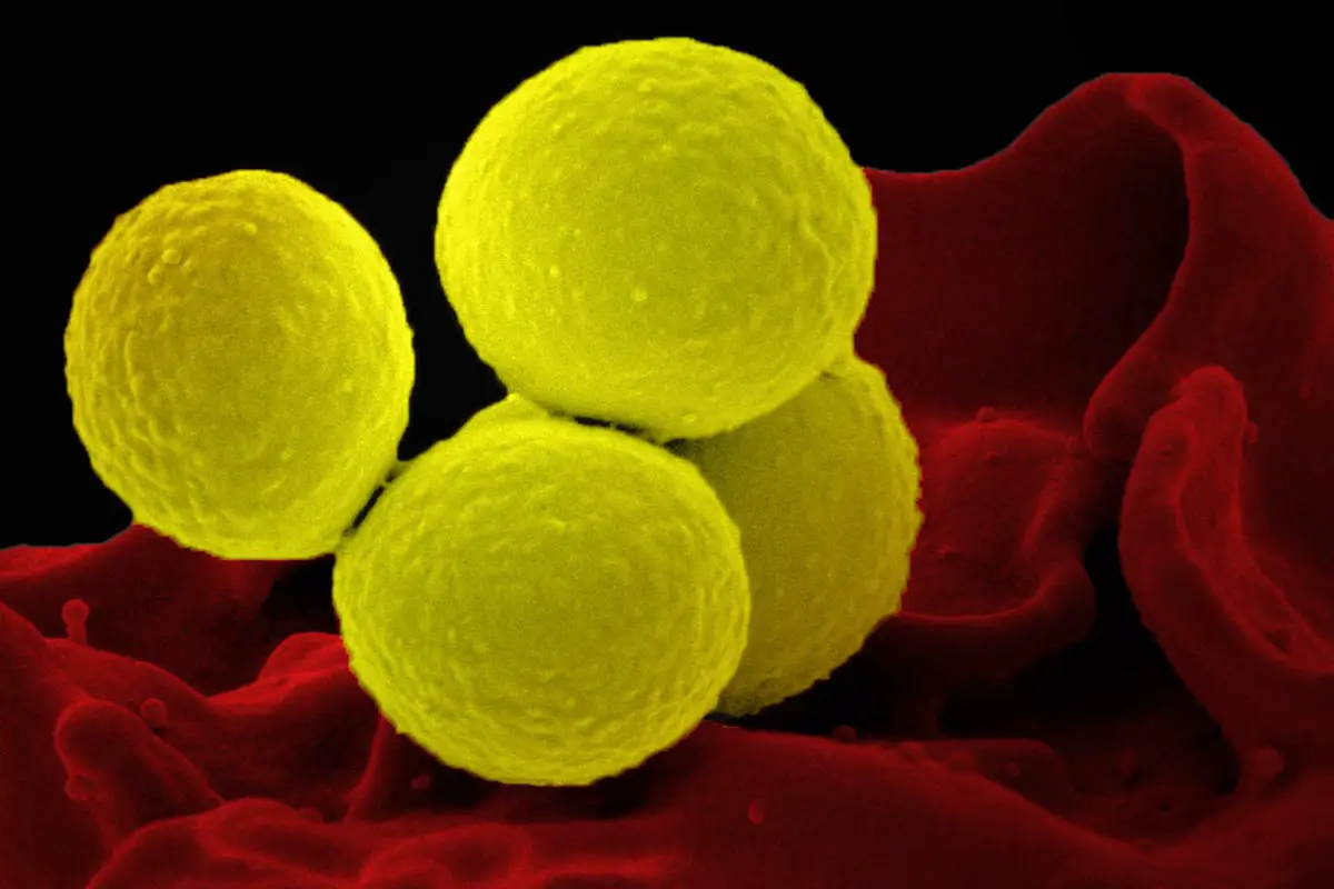 Staphylococcus-aureus-Bacteria-SEM.webp