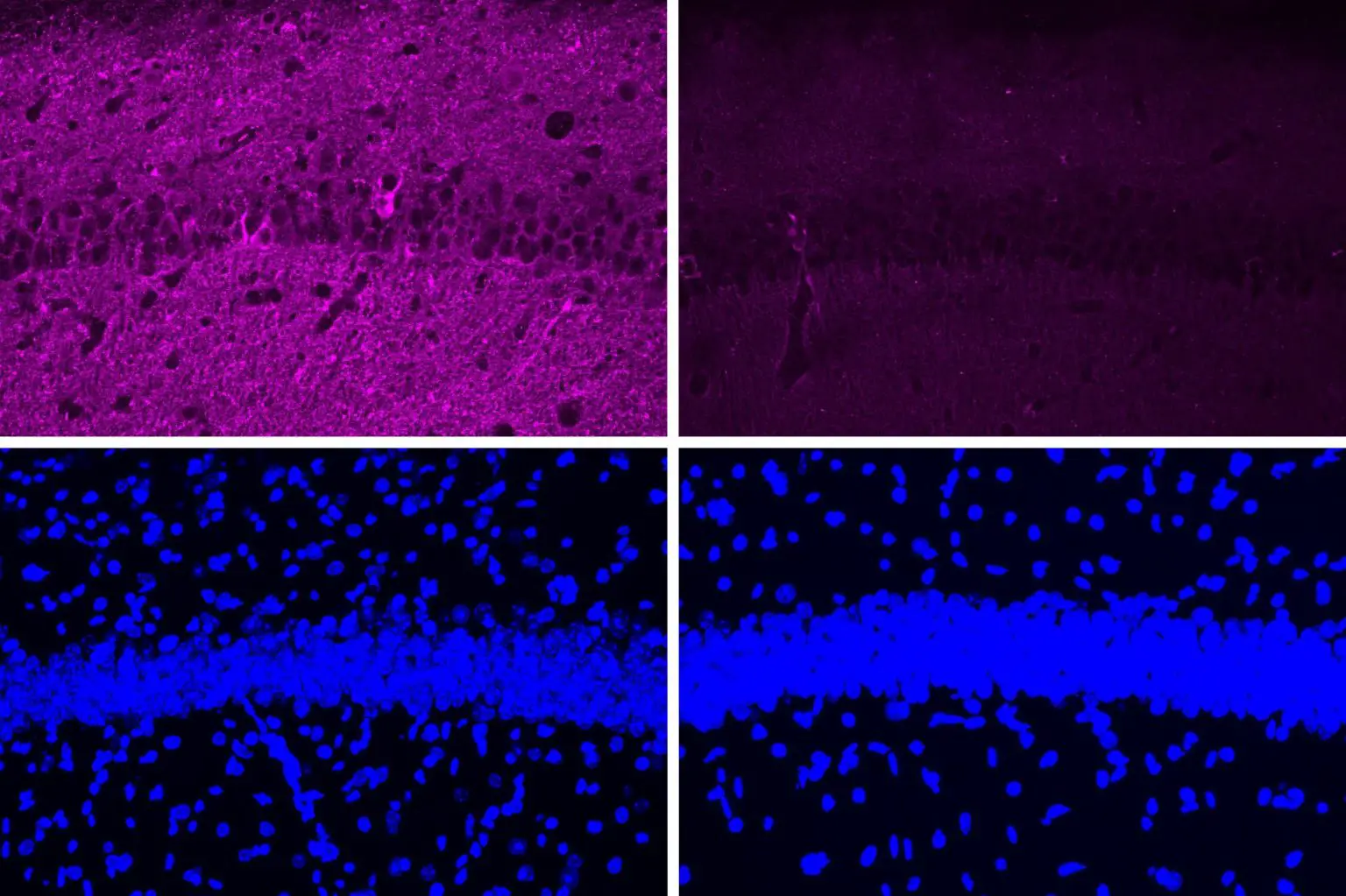 New-Peptide-Alzheimers-Treatment-1536x1023.webp