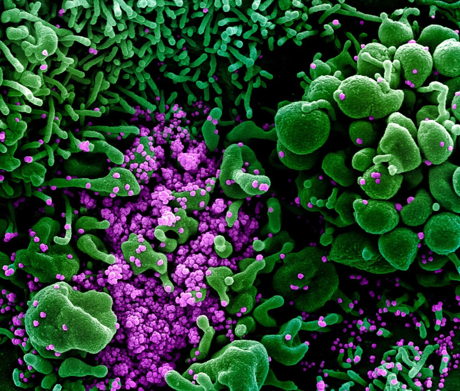 Apoptotic-Cell-Heavily-Infected-With-SARS-COV-2-Virus-1536x1306.webp