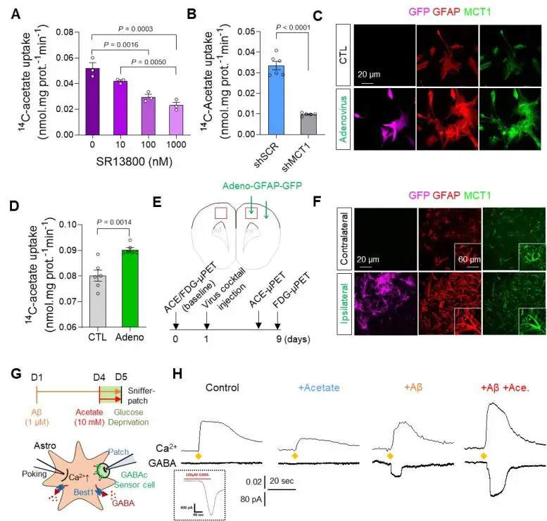 New-Breakthrough-in-Alzheimers-Disease-Research-Figure-1-777x740.webp