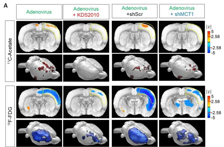 New-Breakthrough-in-Alzheimers-Disease-Research-Figure-2-777x510.webp