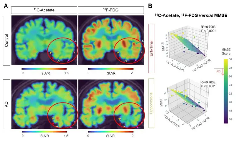 New-Breakthrough-in-Alzheimers-Disease-Research-Figure-3-777x458.webp
