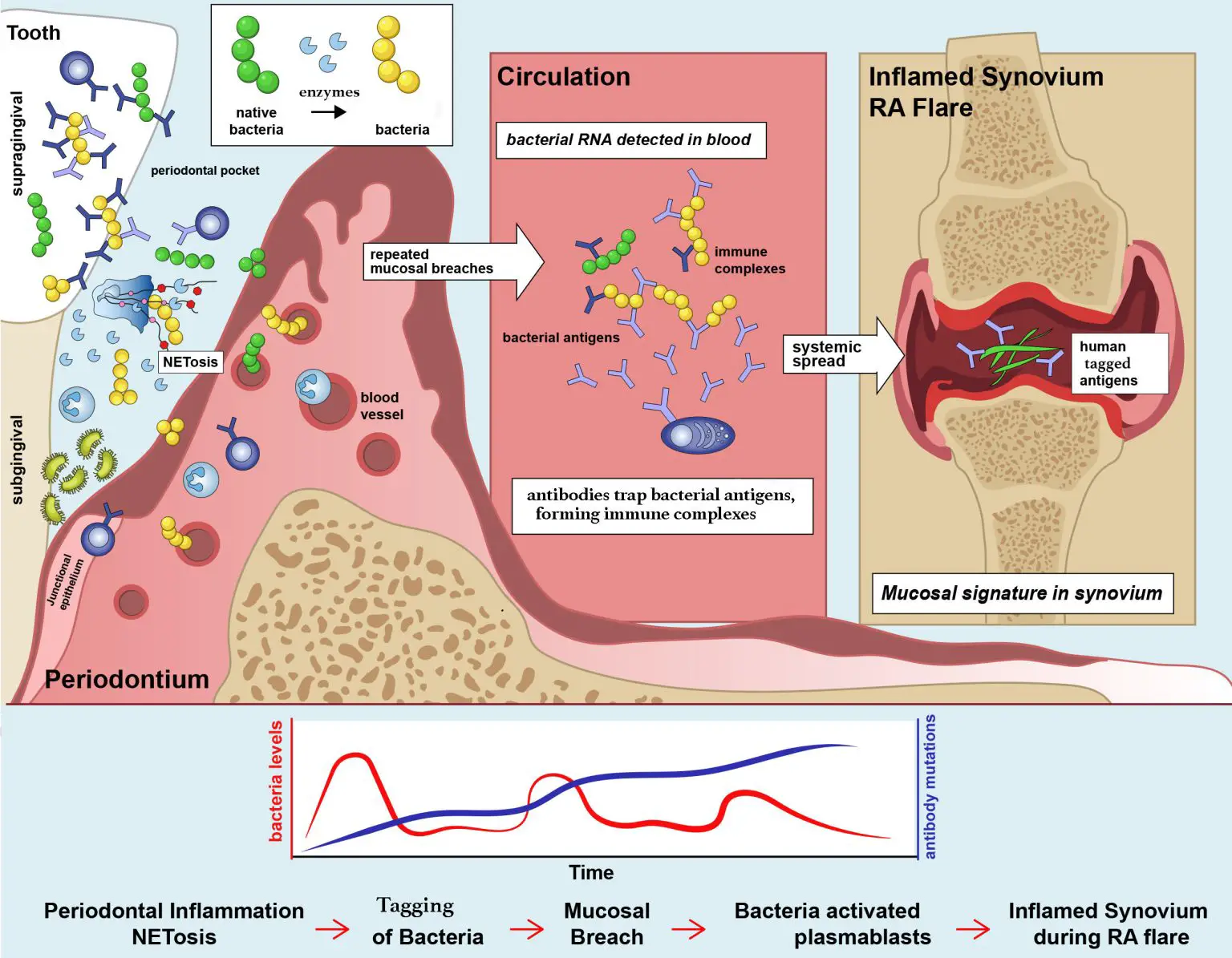 Proposed-Model-for-the-Role-of-Periodontal-Inflammation-in-Rheumatoid-Arthritis-1536x1195.webp