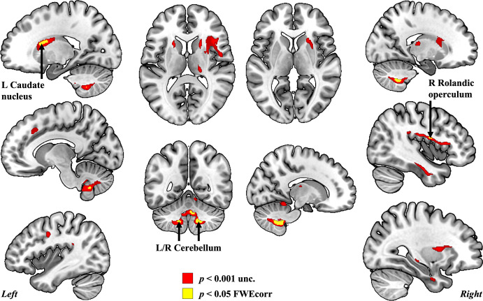 1-s2.0-S2666956023000119-gr3.jpg