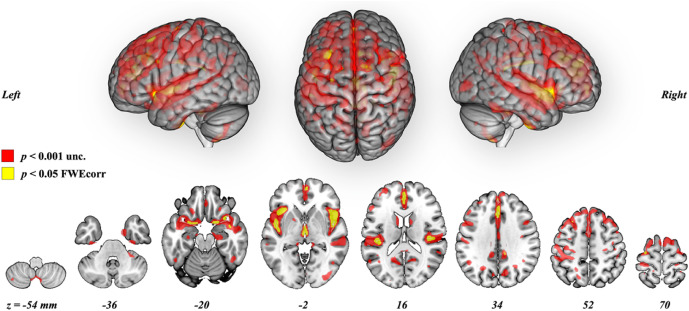 1-s2.0-S2666956023000119-gr7.jpg