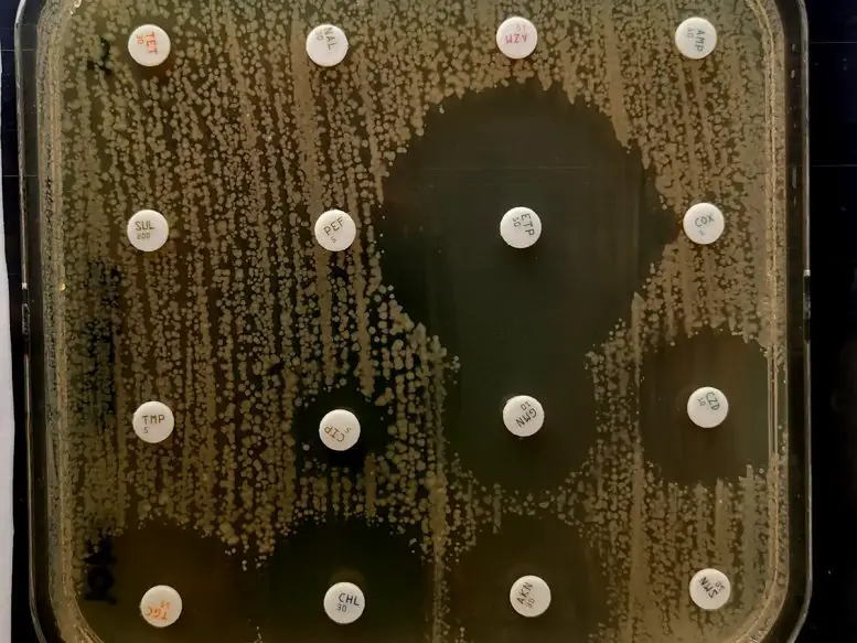 Antibiogram-of-XDR-Extensively-Drug-Resistant-Shigella-sonnei-777x583.webp