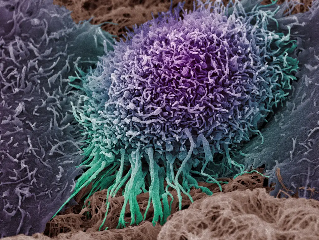 Human-Oral-Squamous-Carcinoma-Cell-2048x1540.webp