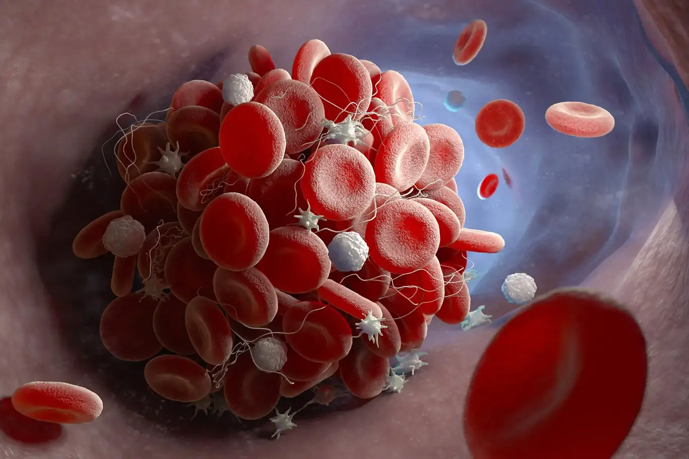 Blood-Clot-Illustration.webp