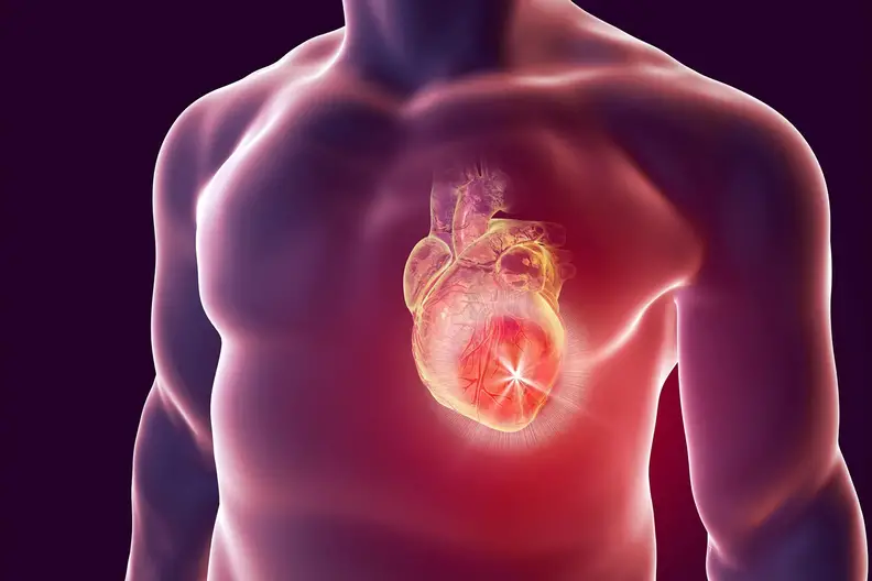 Man-Heart-Attack-Cardiology-Illustration.webp
