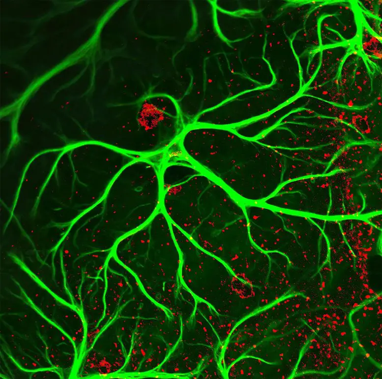 Role-of-Octopamine-in-Neurodegeneration-777x770.webp