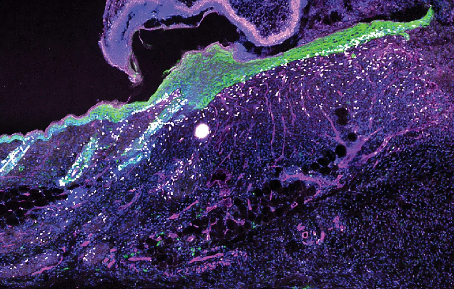 Cells-Five-Day-Old-Wound-1536x981.webp