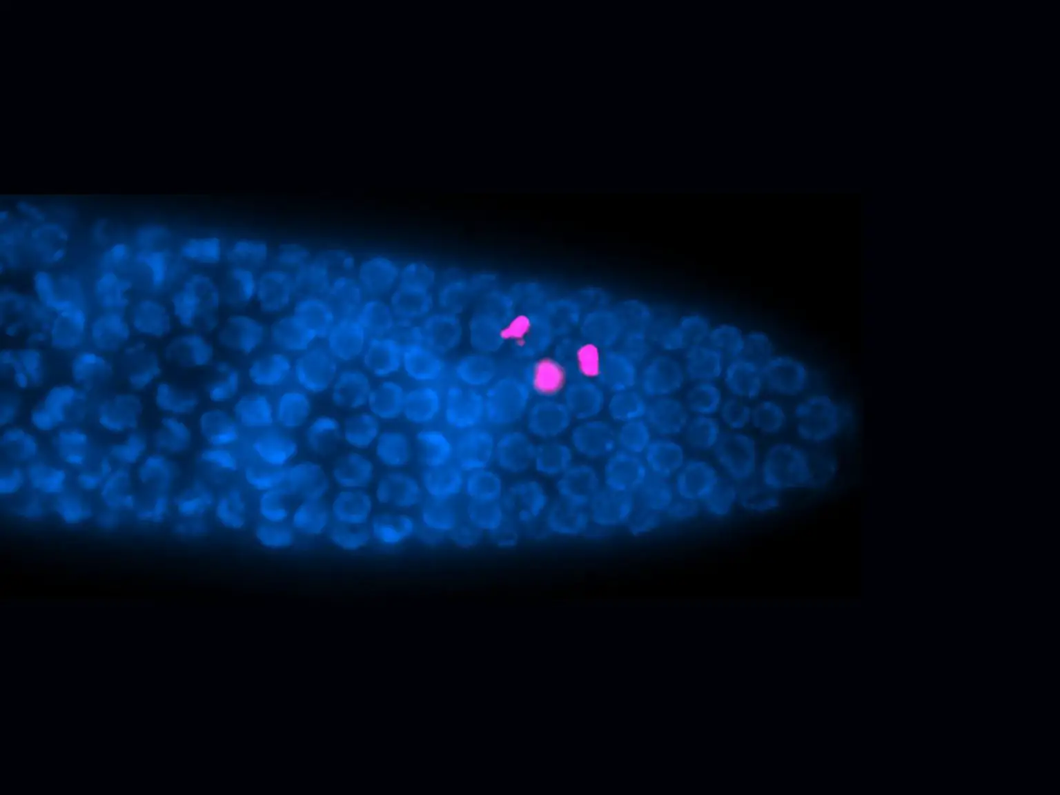 Roundworm-Gonad-1536x1152.webp