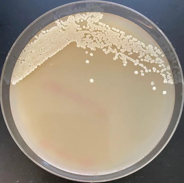 Streptomyces-Sample-777x772.webp