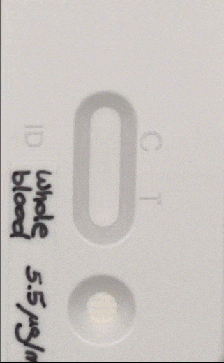 Lateral-Flow-Assay-for-Calprotectin.gif