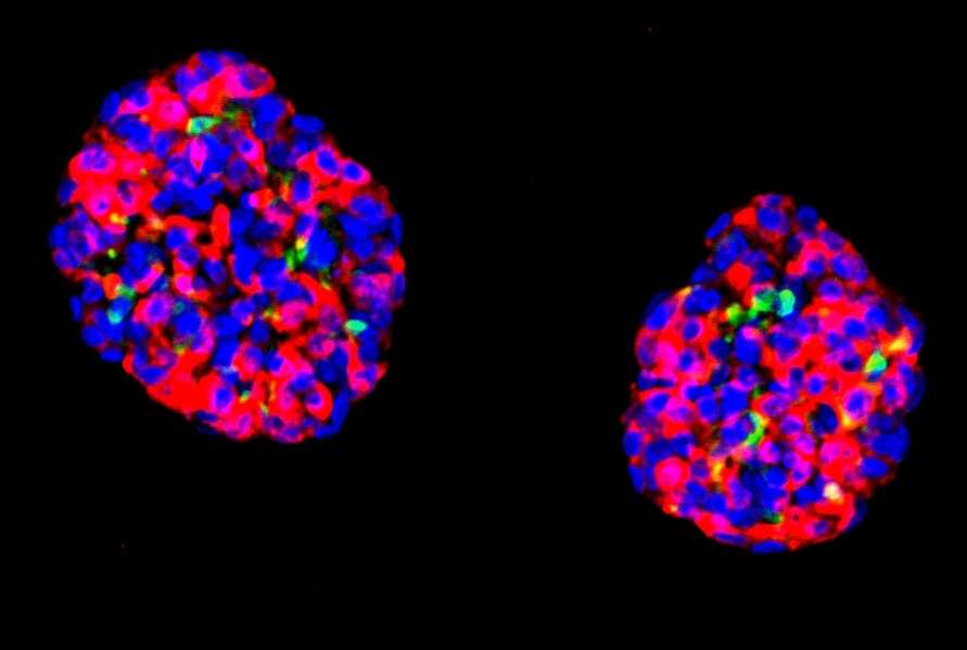 zhou_gins_islet_organoids.jpg