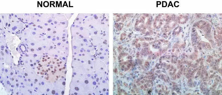 Normal-PDAC-Pancreas-Cells-777x334.webp