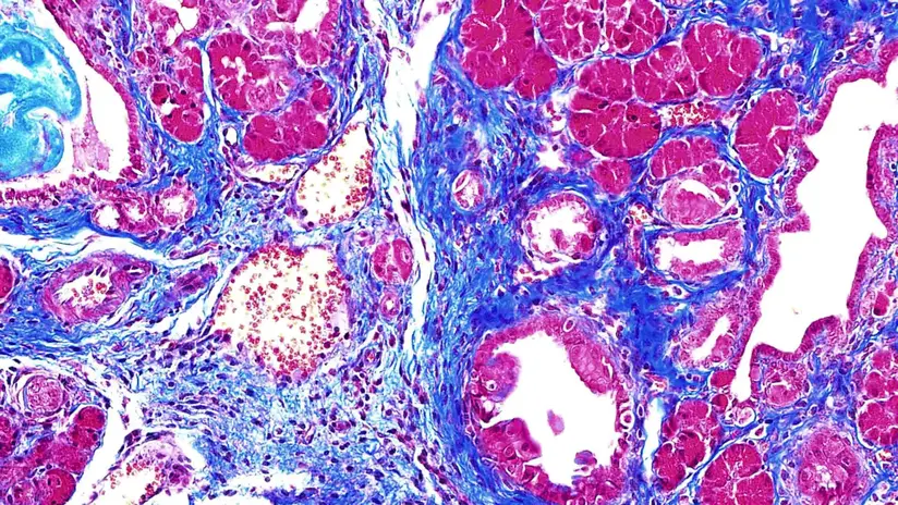 Mouse-Pancreas.webp
