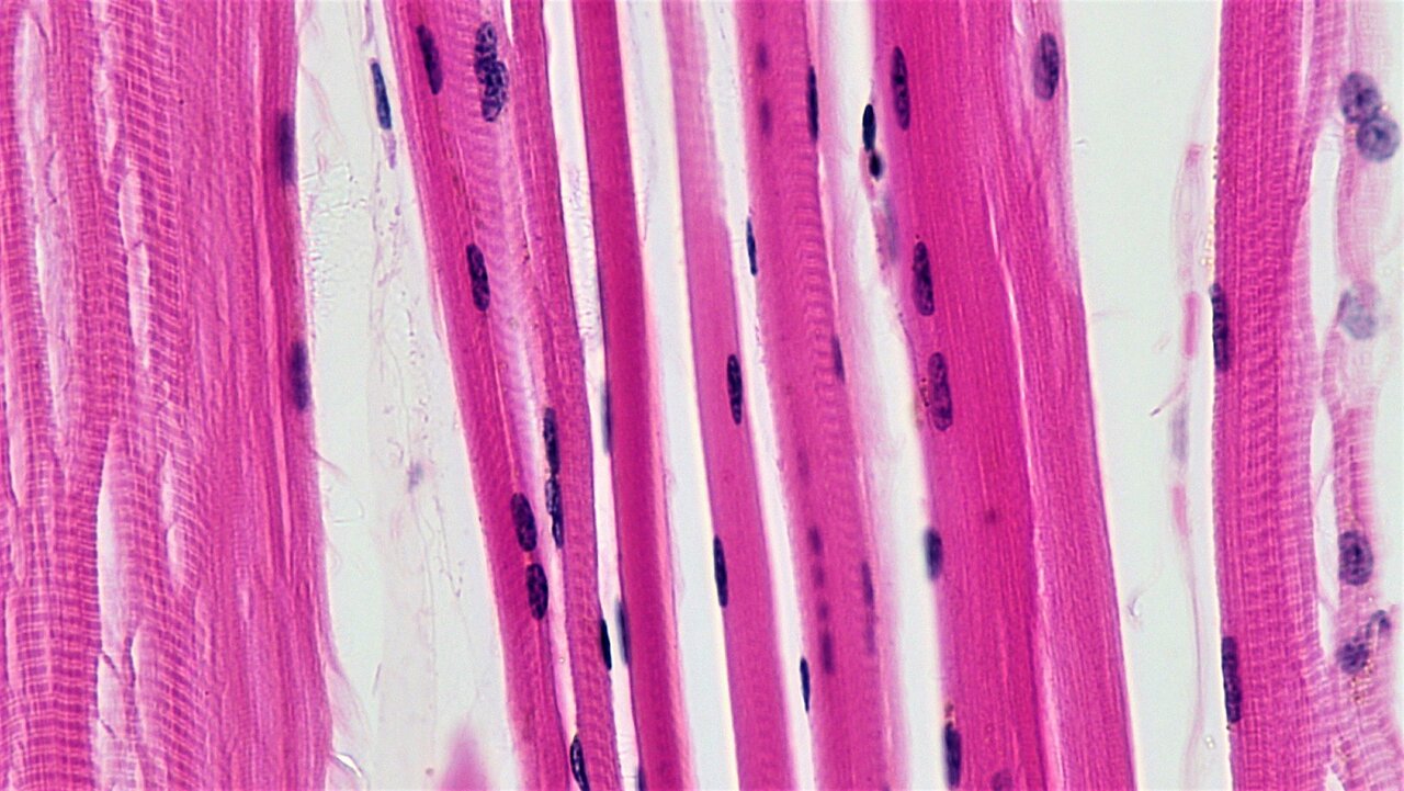 6051f45fe0d51.jpg
