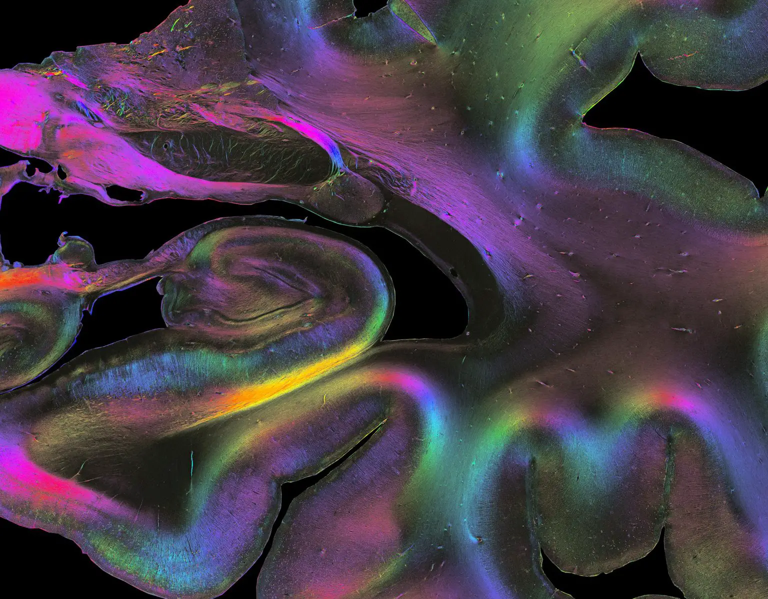 Fiber-Architecture-of-Human-Hippocampus-1536x1198.webp