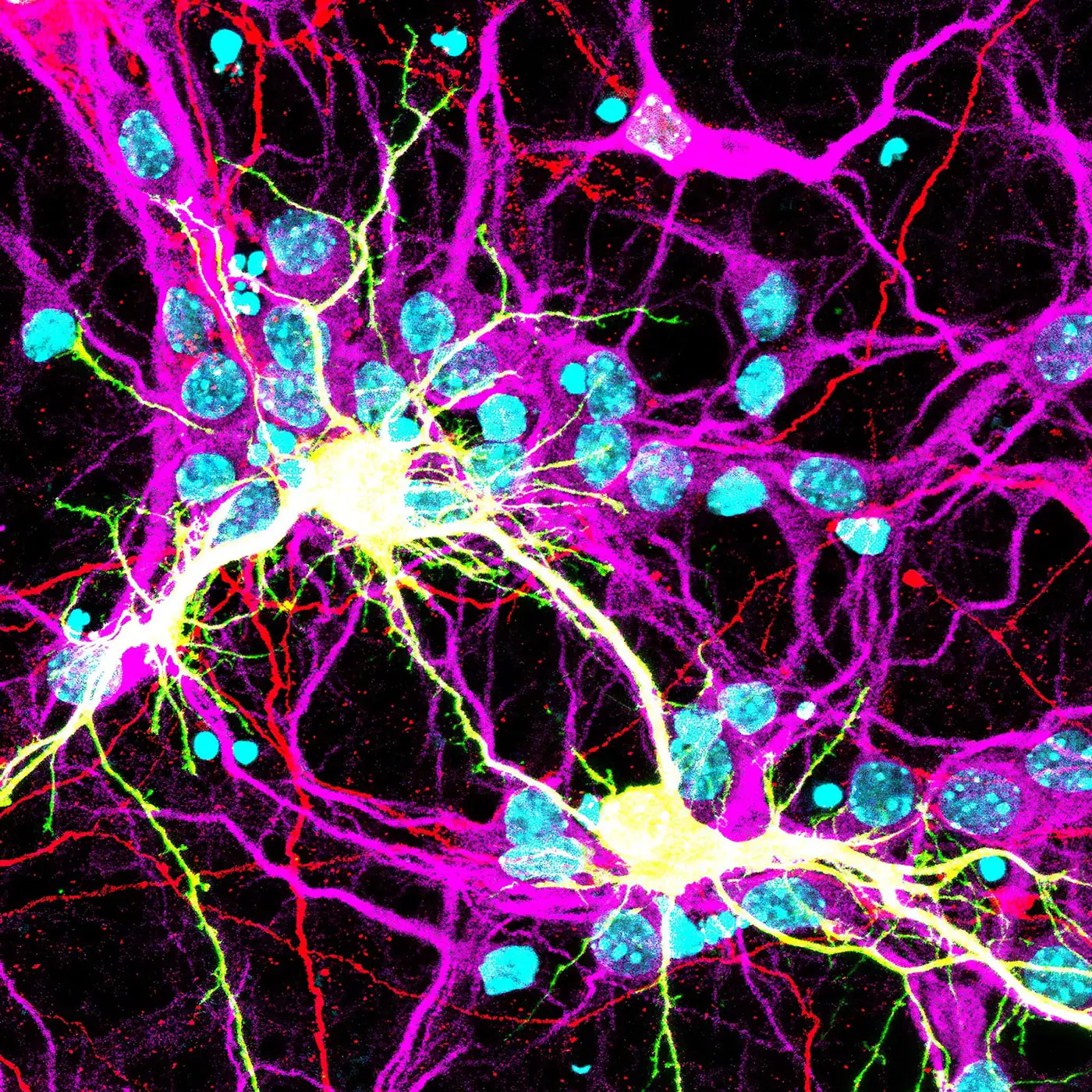 Fused-Neurons-Expressing-the-COVID-19-Spike-Protein.webp