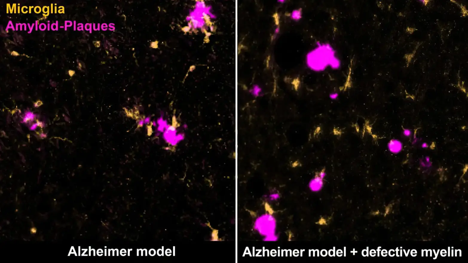Microglia-Amyloid-Plaques-Mouse-Brain.webp