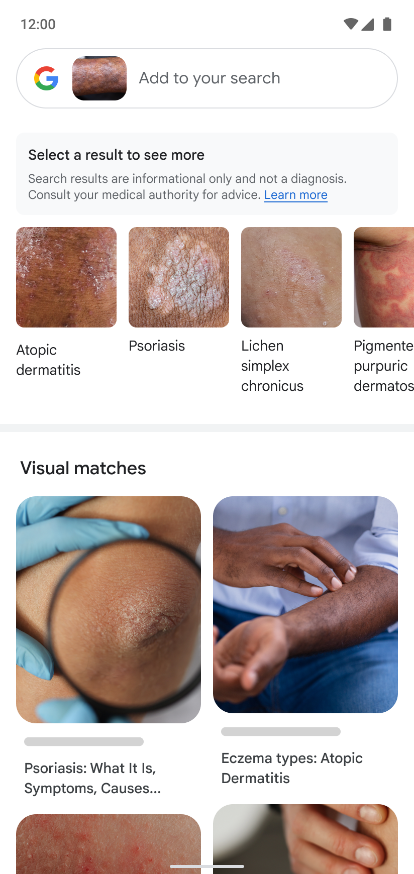 Search-your-skin-with-Lens-still-3-of-3.webp