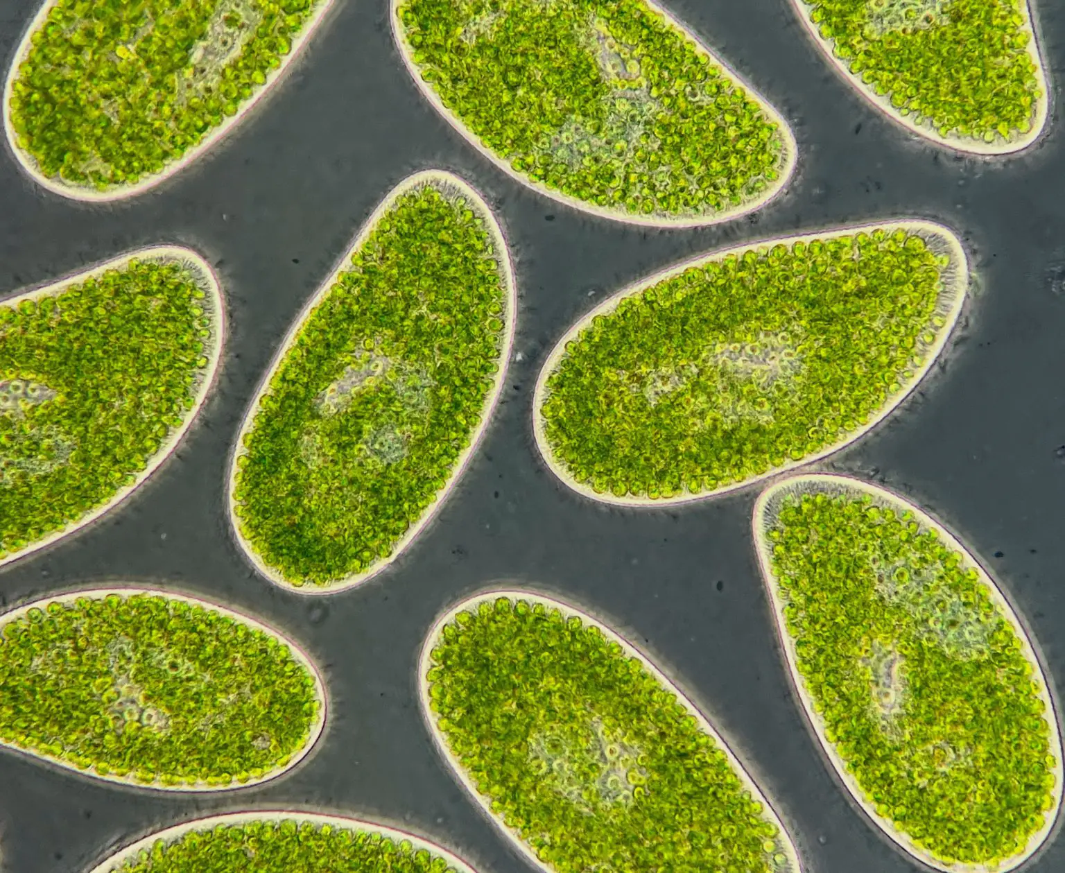 Paramecium-bursaria-1536x1259.webp