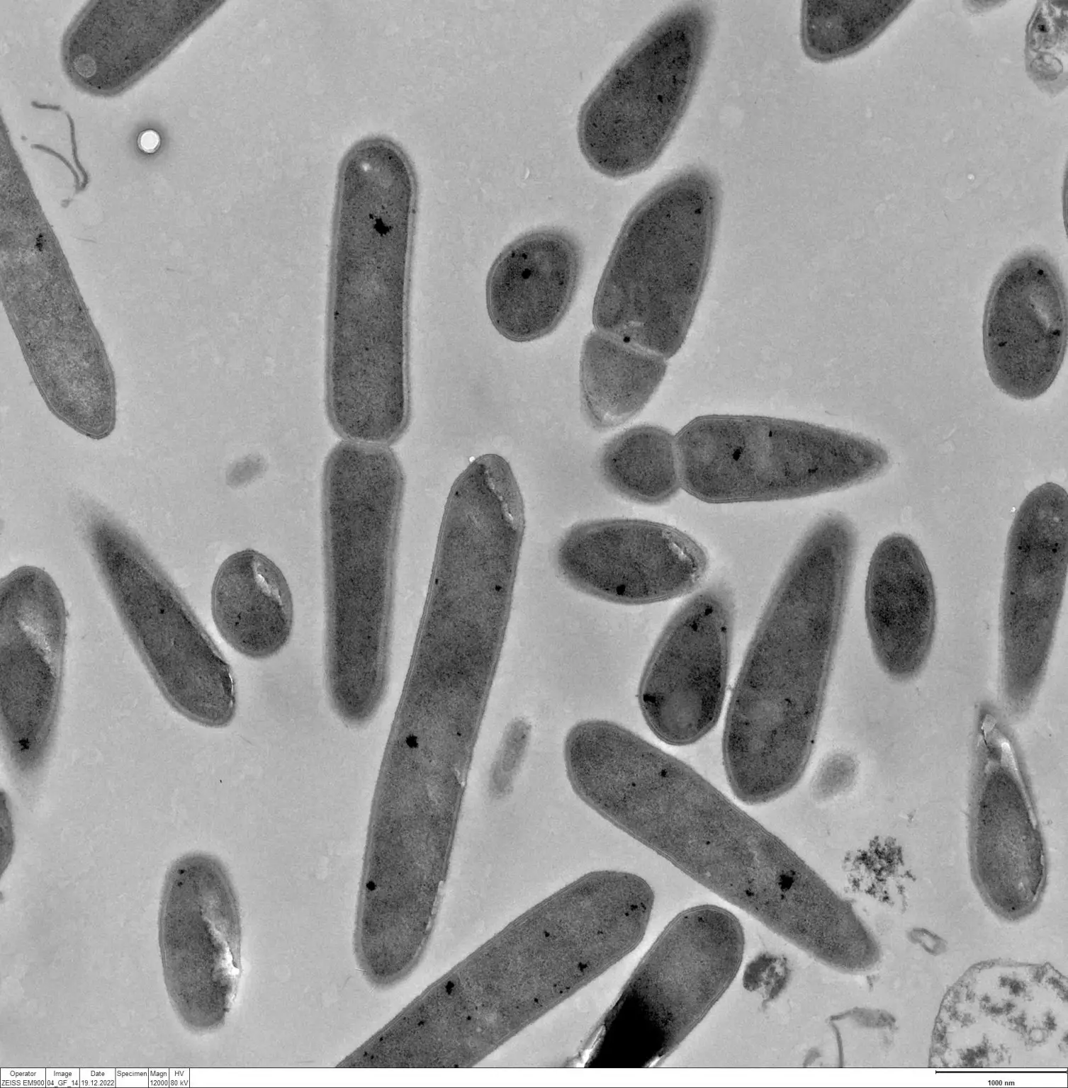 Clostridium-ljungdahlii-1507x1536.webp