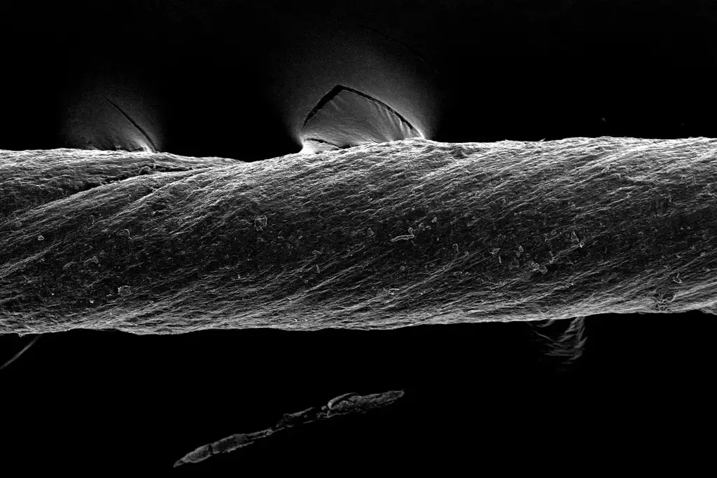Sutures-Deliver-Drugs-Sense-Inflammation.webp